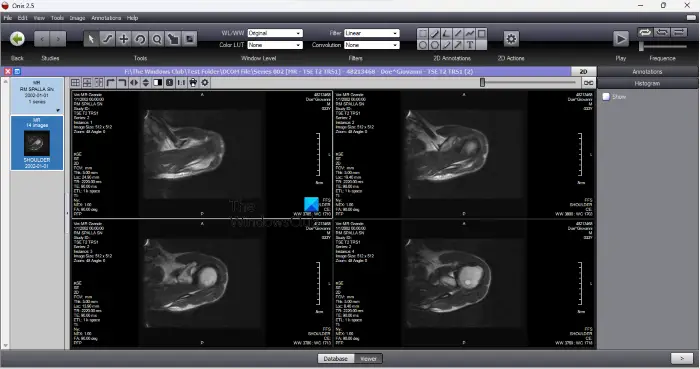 Onis DICOM Viewer